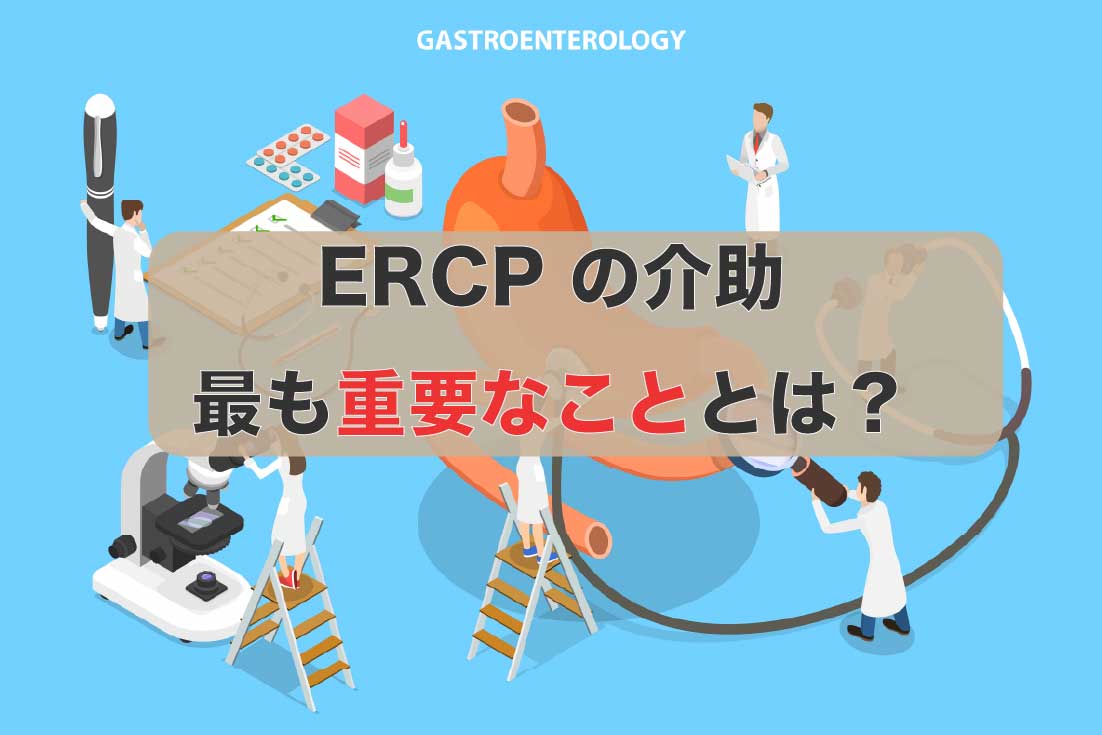 ERCPの介助で最も重要なこととは？と書かれた記事のアイキャッチ画像